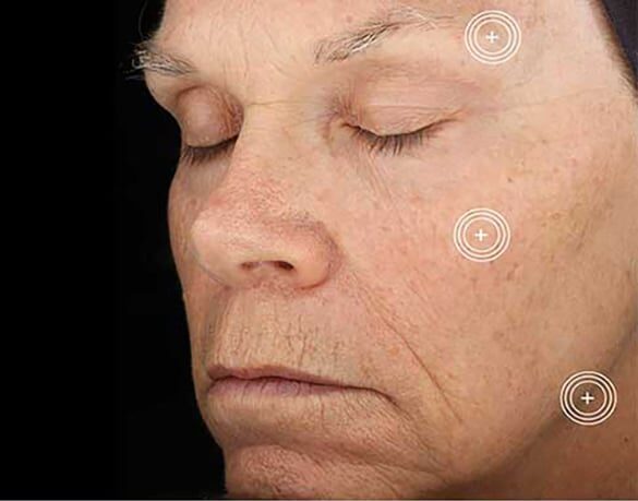 24 week after new 1 24 week after new 1