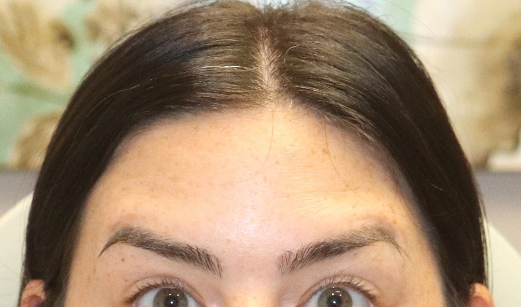 After Image: Xeomin - front