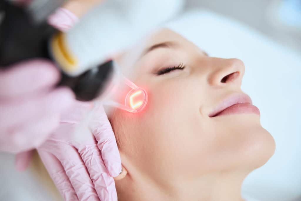 Close up of a smiling woman with smooth skin getting CO2RE laser resurfacing treatment