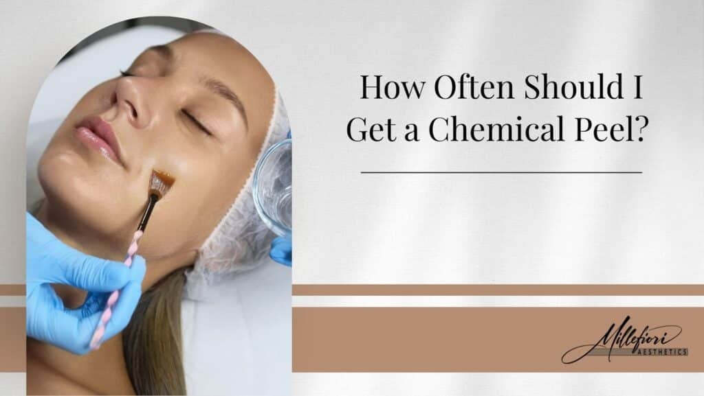 When should I get a chemical peel