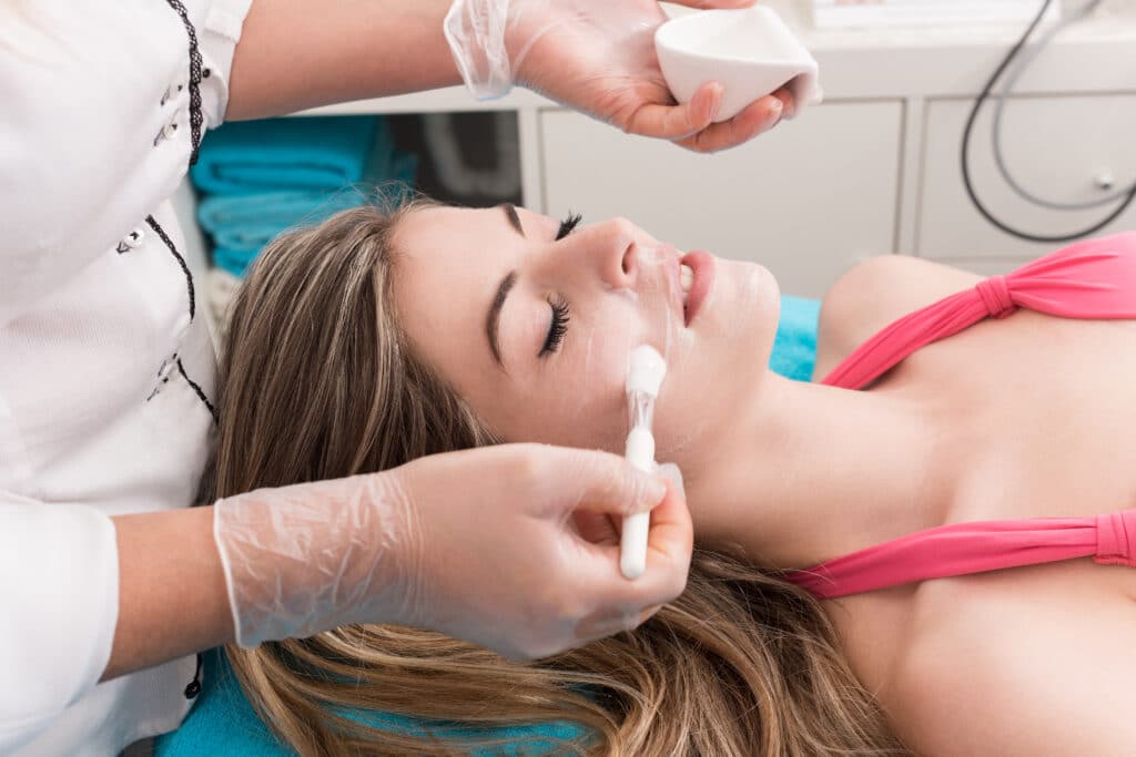 Woman having the Perfect Peel chemical peel applied to her face for smoother, radiant skin