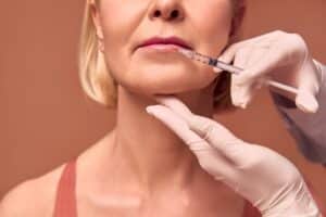 Close up of an older woman having lip filler placed by a profession injector to prevent migration.
