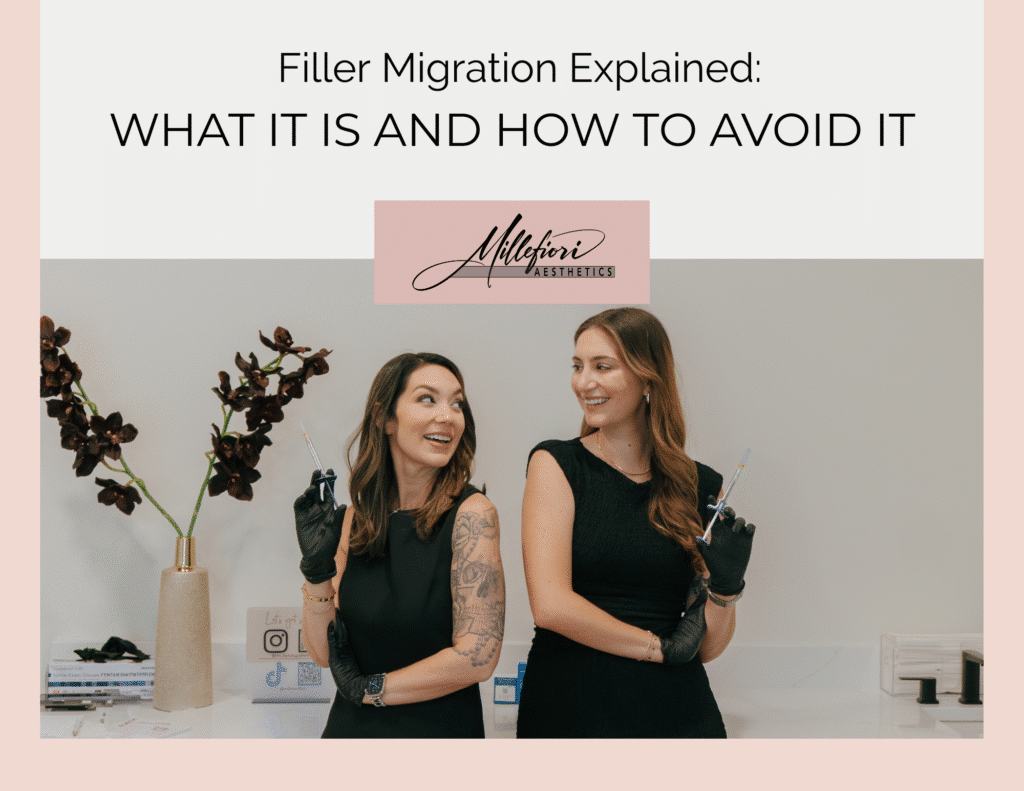 filler migration