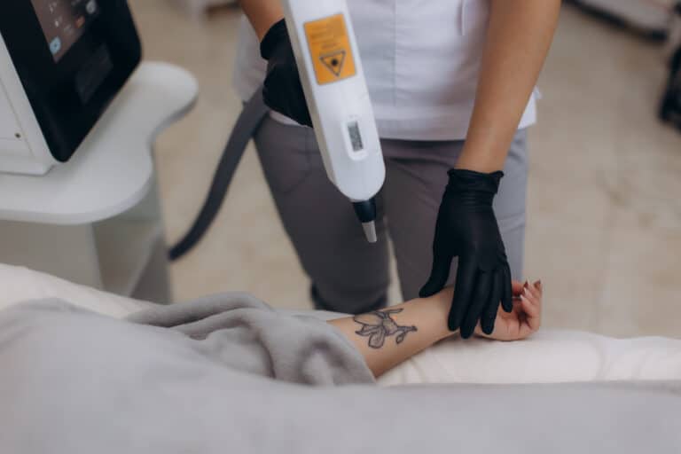 Does Tattoo Removal Hurt? What PicoSure Patients Should Know