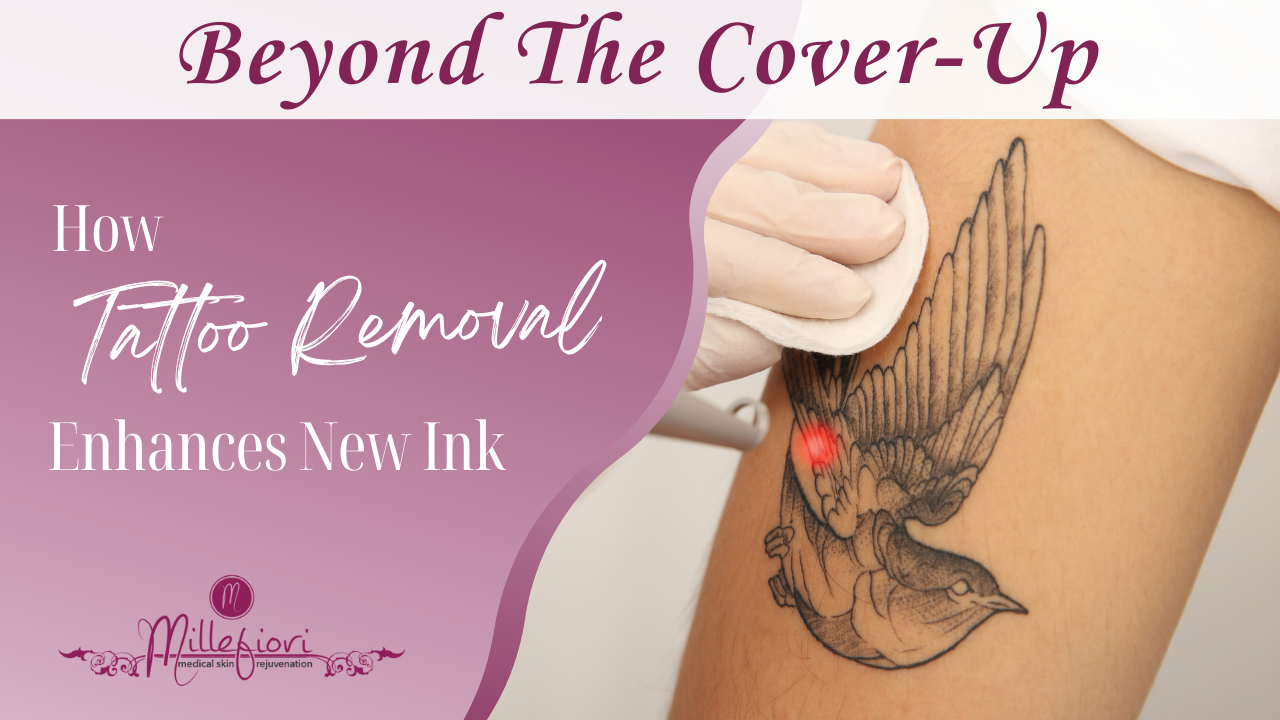 New tattoo - 2nd skin not a full cover : r/tattooadvice