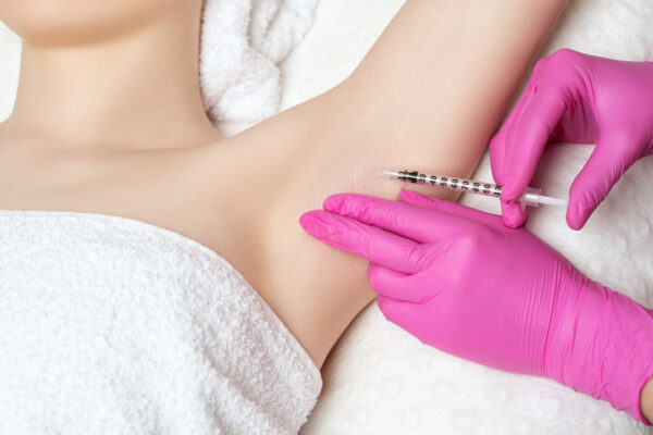 Woman being treated with Botox® injections for hyperhidrosis in her underarms