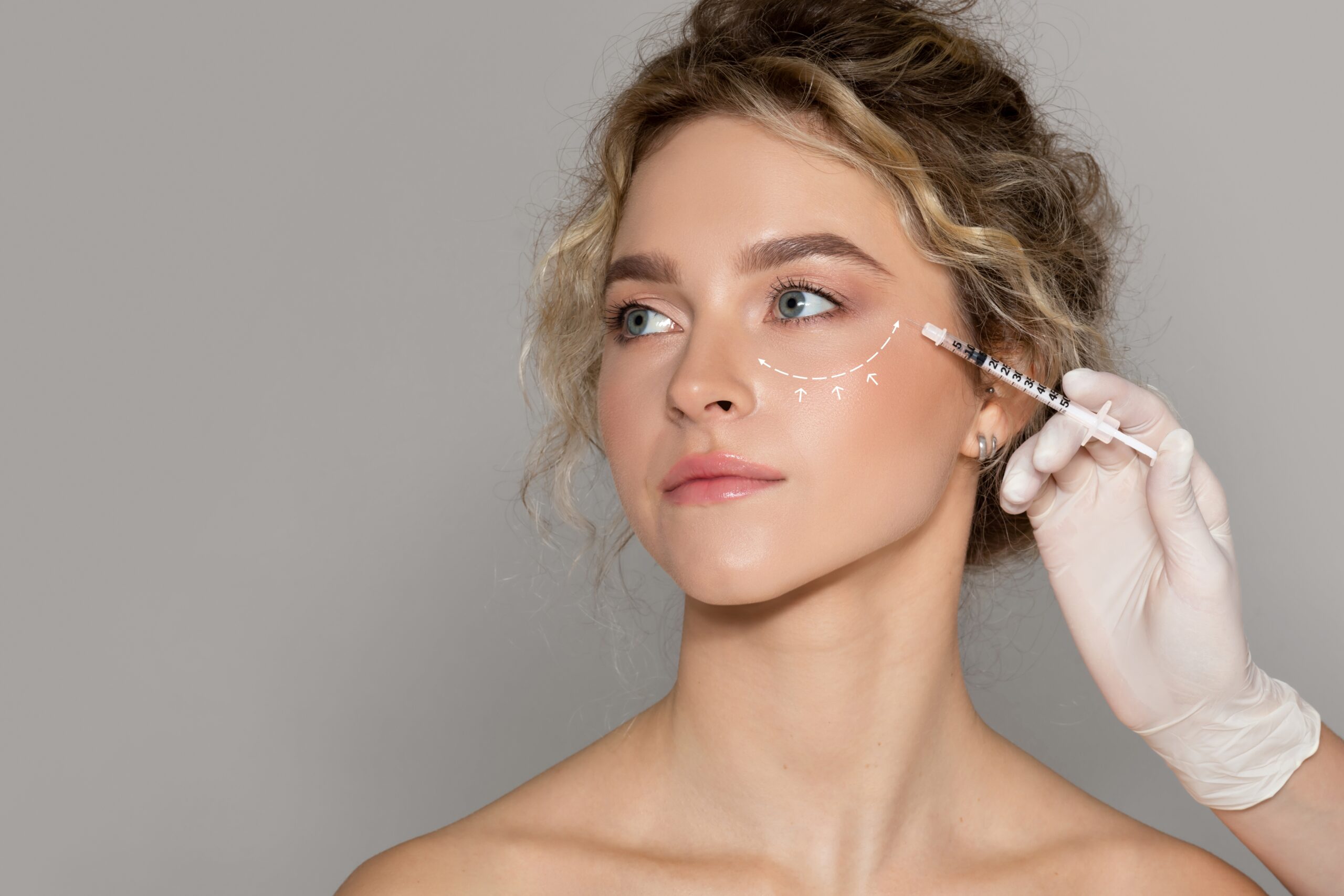 Your Guide to Undereye Filler